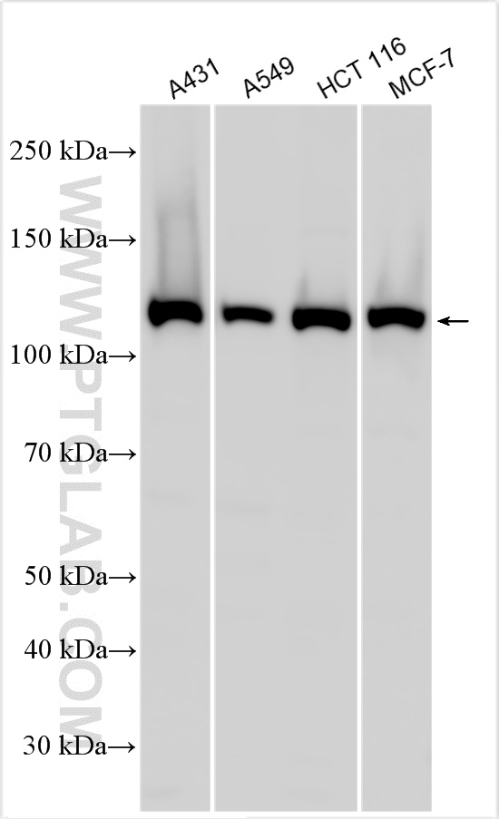 WB analysis using 51075-2-AP