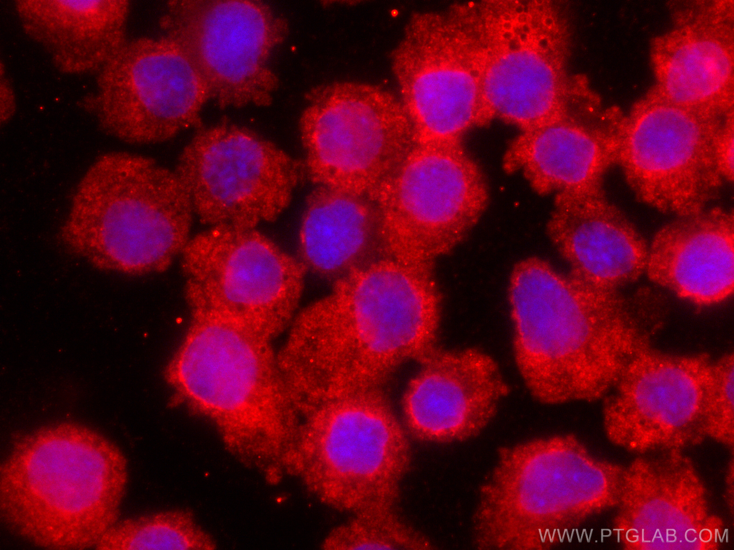 IF Staining of Ramos using CL594-66485