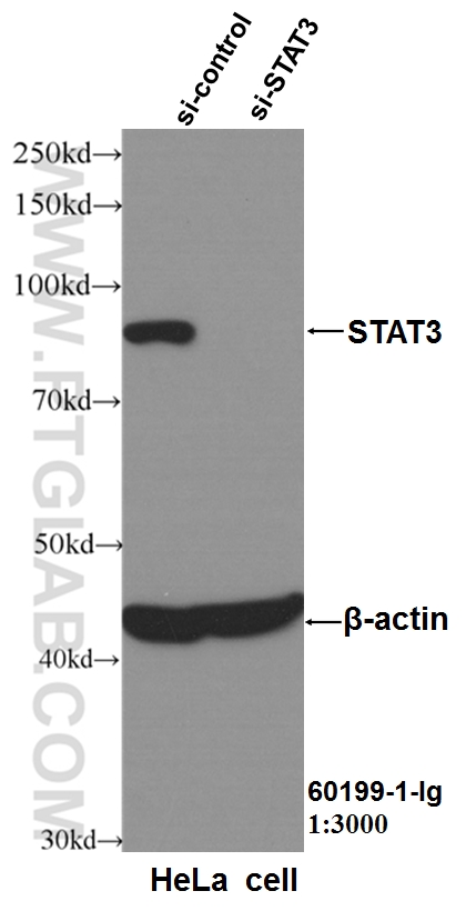 STAT3 Monoclonal antibody