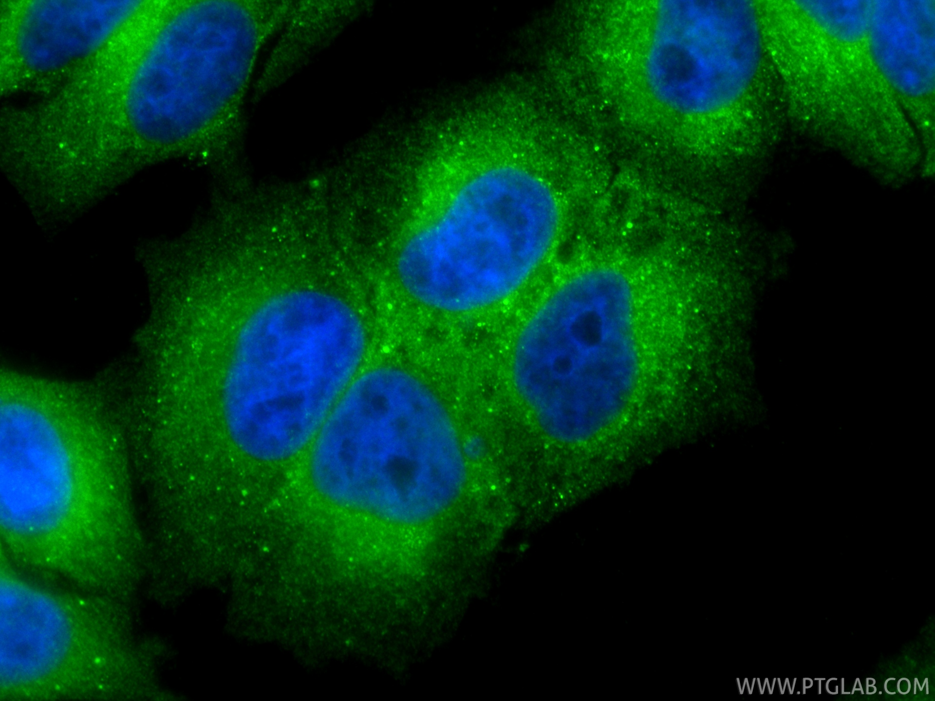 IF Staining of HepG2 using 13028-1-AP