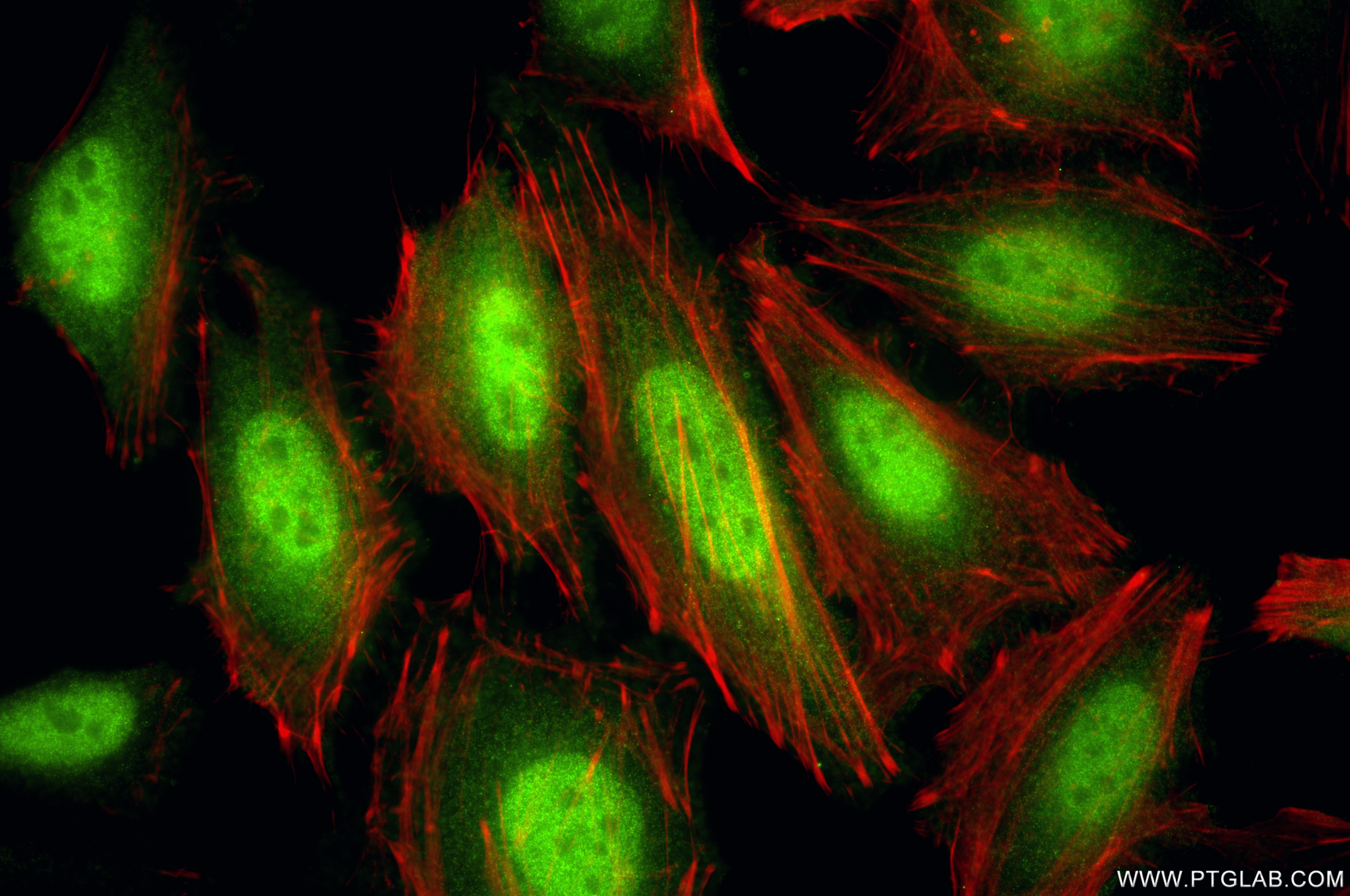 Immunofluorescent analysis of (4% PFA) fixed HeLa cells using STAT5B antibody (<a class='green' href='/productredirect?CatalogNo=87224-2-RR' target='_blank'>87224-2-RR</a>, Clone: 252436G2 ) at dilution of 1:400 and CoraLite®488-Conjugated Goat Anti-Rabbit IgG(H+L) (<a class='green' href='/productredirect?CatalogNo=SA00013-2' target='_blank'>SA00013-2</a>), CL594-Phalloidin (red). This data was developed using the same antibody clone with 87224-2-PBS in a different storage buffer formulation. IF Staining of HeLa using 87224-2-RR (same clone as 87224-2-PBS)