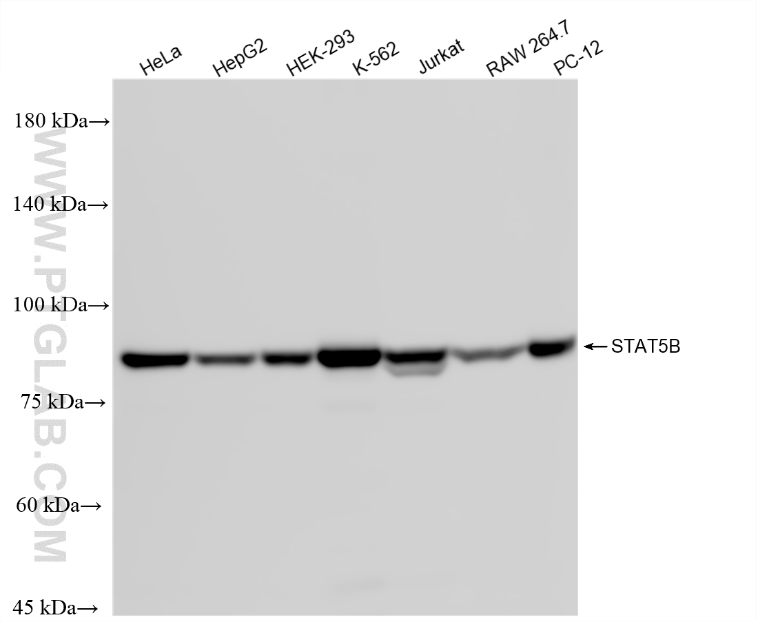 Various lysates were subjected to SDS PAGE followed by western blot with <a class='green' href='/productredirect?CatalogNo=87224-2-RR' target='_blank'>87224-2-RR</a> (STAT5B antibody) at dilution of 1:10000 incubated at room temperature for 1.5 hours. This data was developed using the same antibody clone with 87224-2-PBS in a different storage buffer formulation. WB analysis using 87224-2-RR (same clone as 87224-2-PBS)