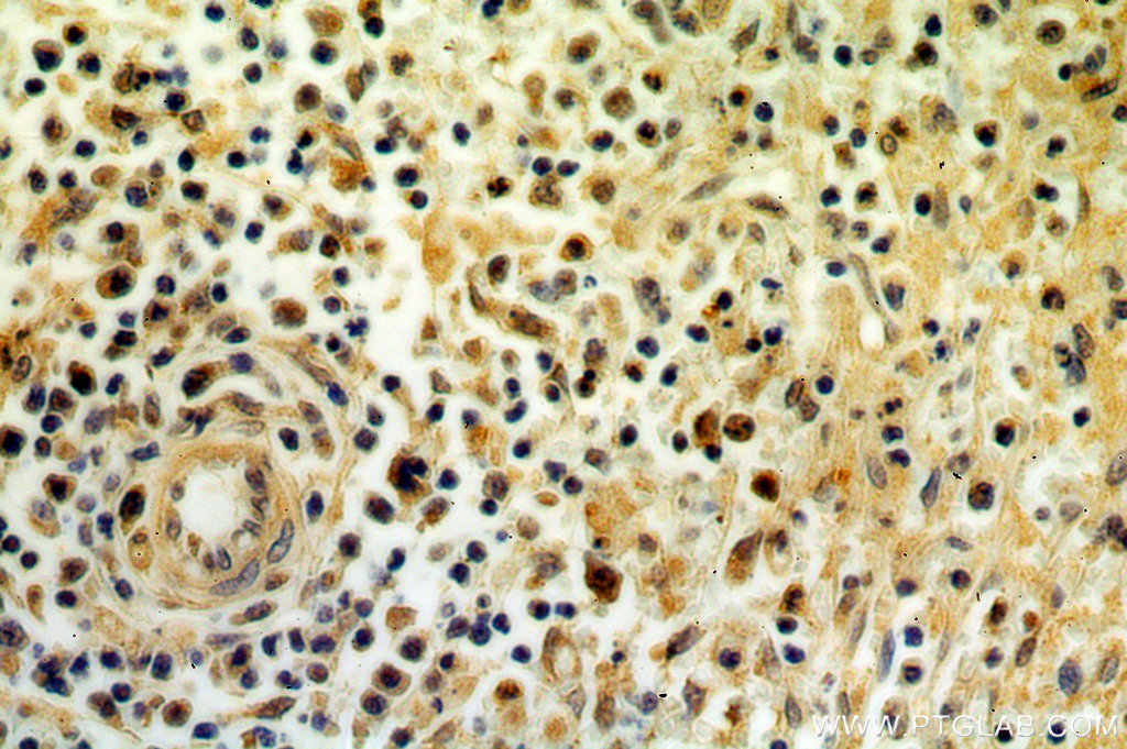 IHC staining of human spleen using 10257-1-AP