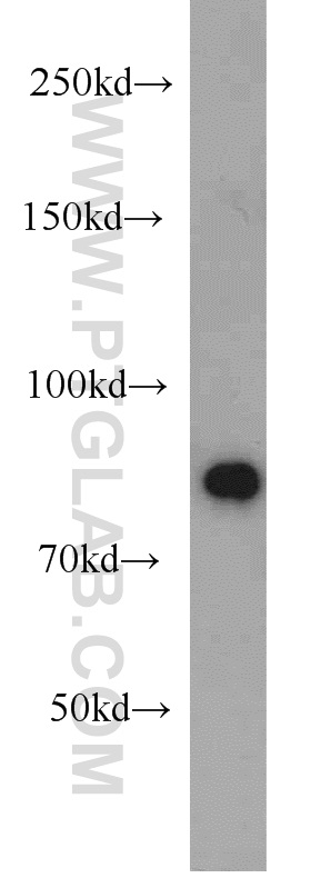 WB analysis of HeLa using 10257-1-AP