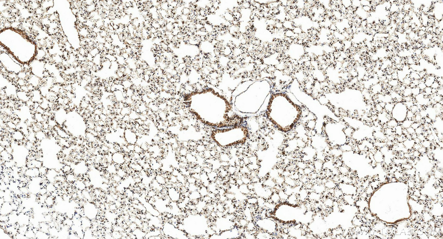 IHC staining of mouse lung using 51073-1-AP