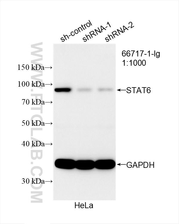 WB analysis of HeLa using 66717-1-Ig