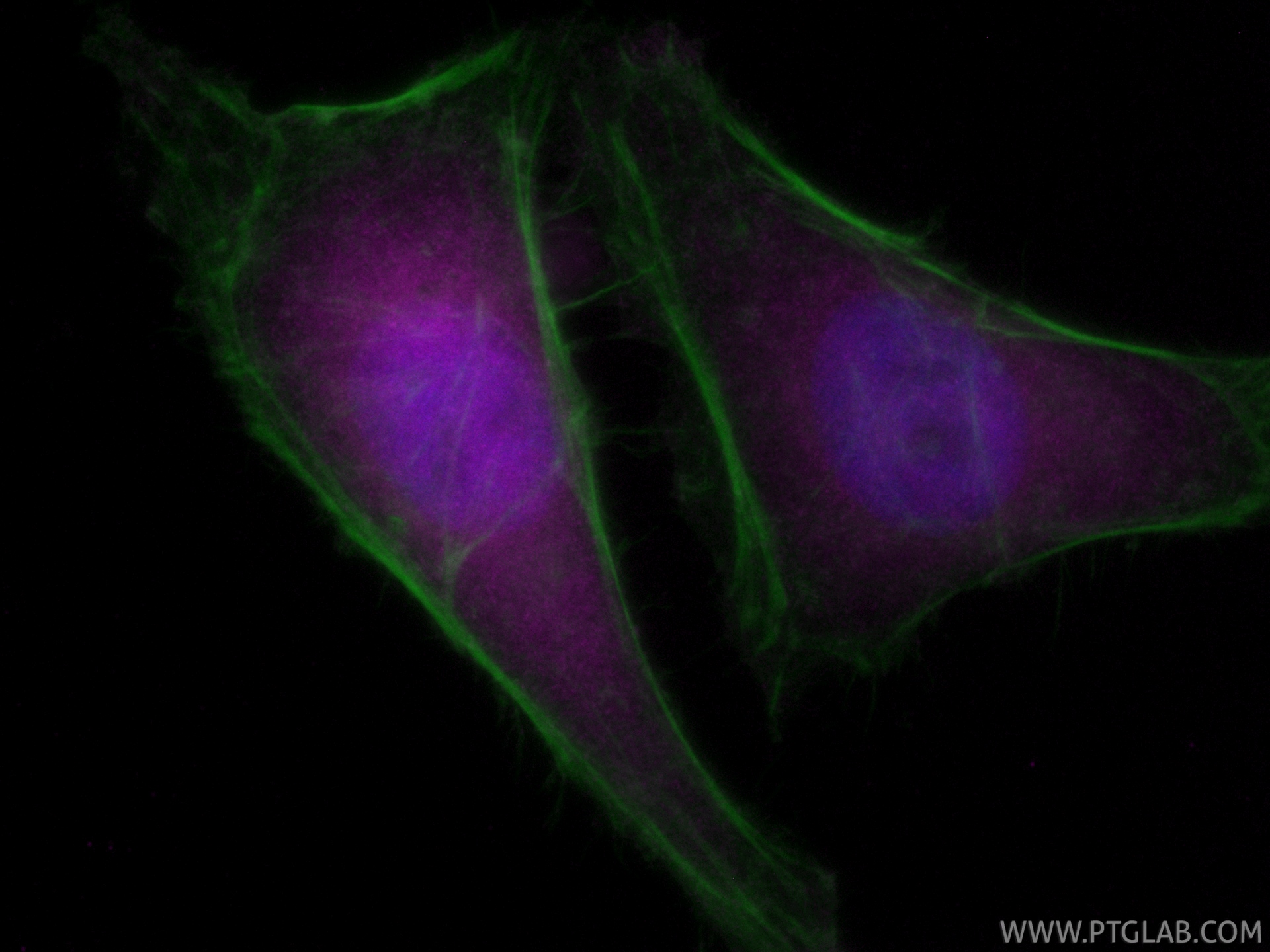 IF Staining of HeLa using CL647-82630 IF Staining of HeLa using CL647-82630