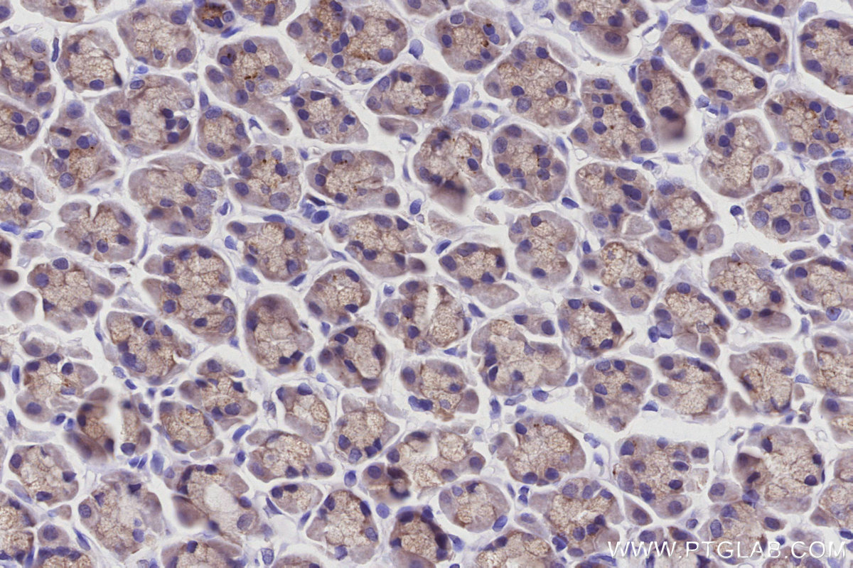 IHC staining of rat stomach using 15998-1-AP IHC staining of rat stomach using 15998-1-AP