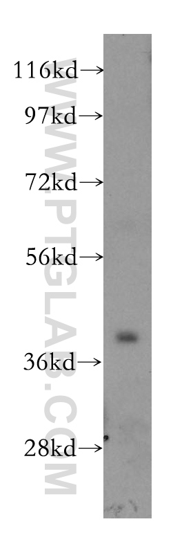 WB analysis of mouse skeletal muscle using 11842-1-AP