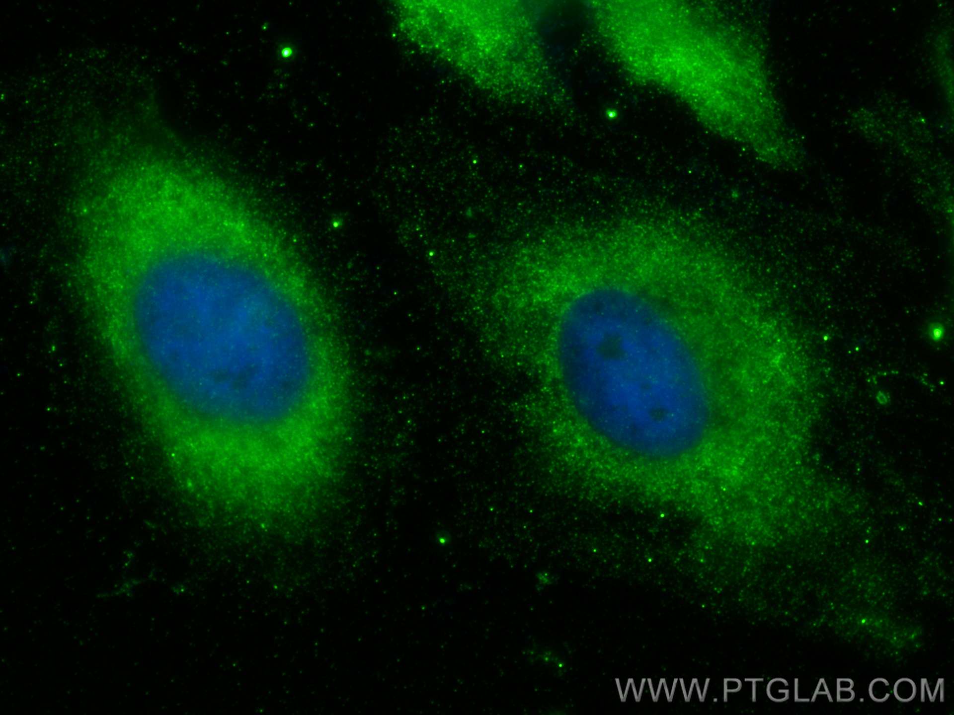 IF Staining of HeLa using 67018-1-Ig