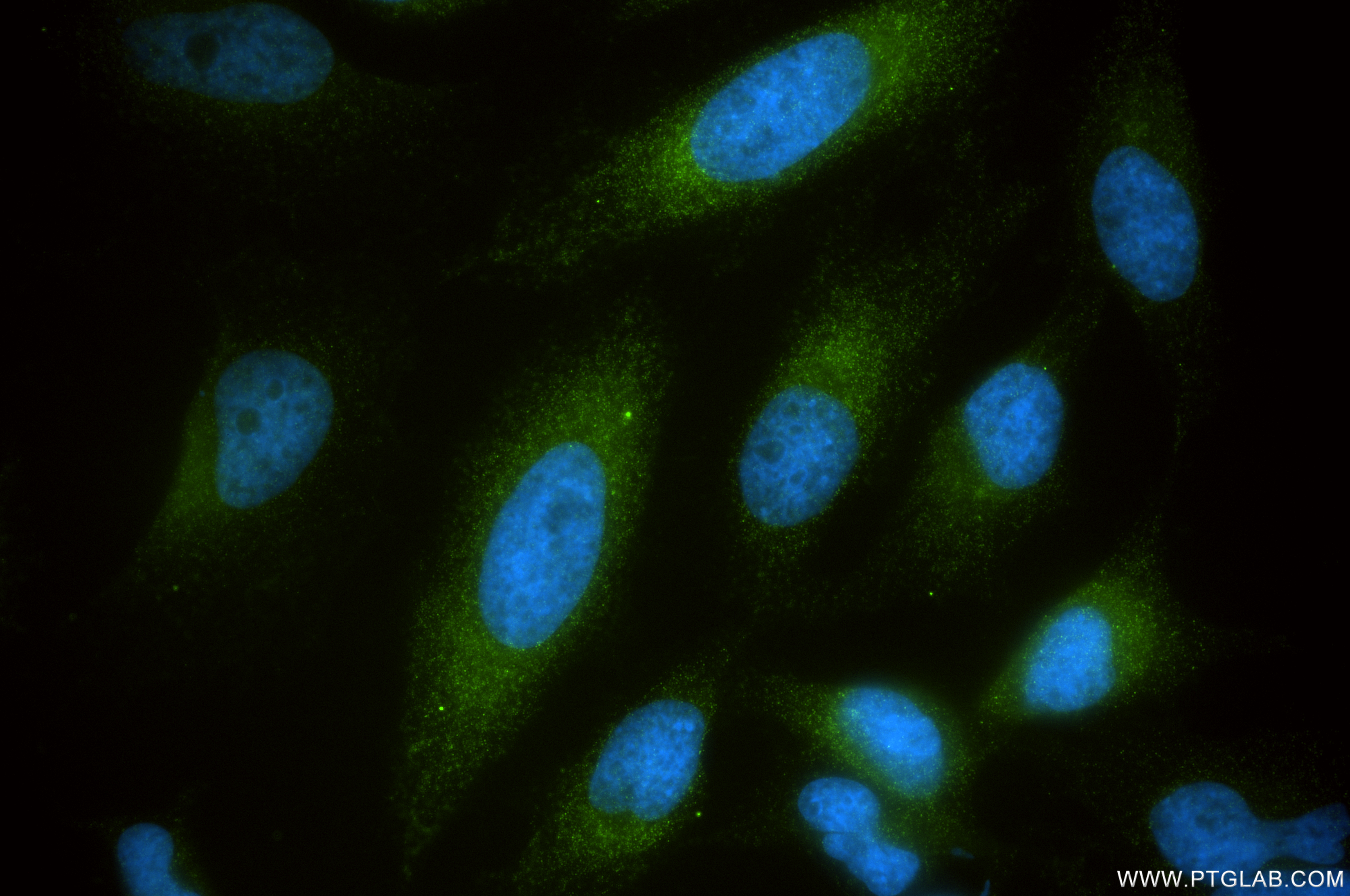 IF Staining of HeLa using 87526-1-RR IF Staining of HeLa using 87526-1-RR