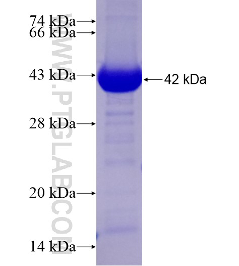 STBD1 fusion protein Ag28613 SDS-PAGE