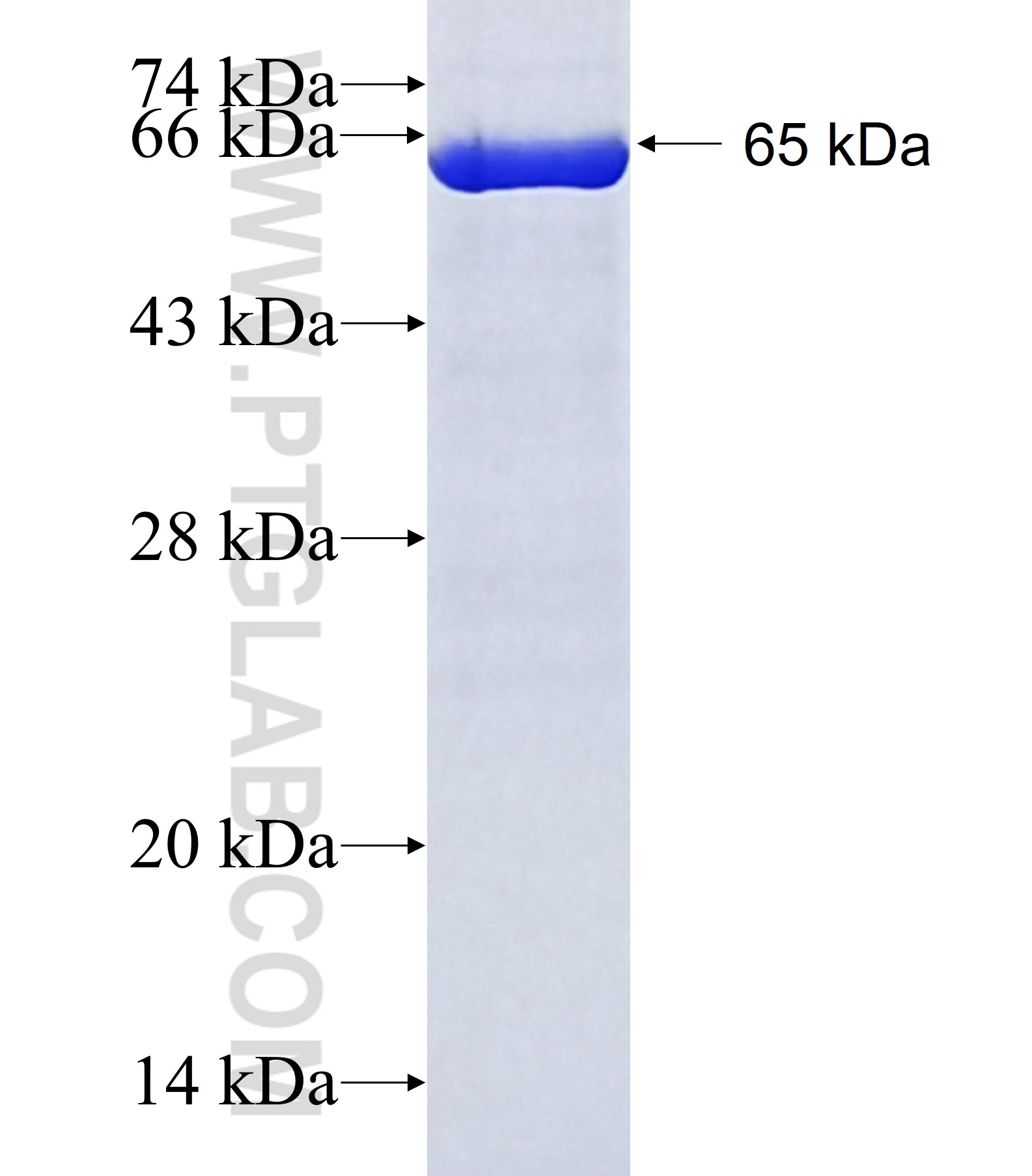 STBD1 fusion protein Ag2481 SDS-PAGE