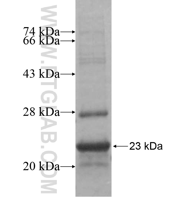 STC1 fusion protein Ag16277 SDS-PAGE STC1 fusion protein Ag16277 SDS-PAGE