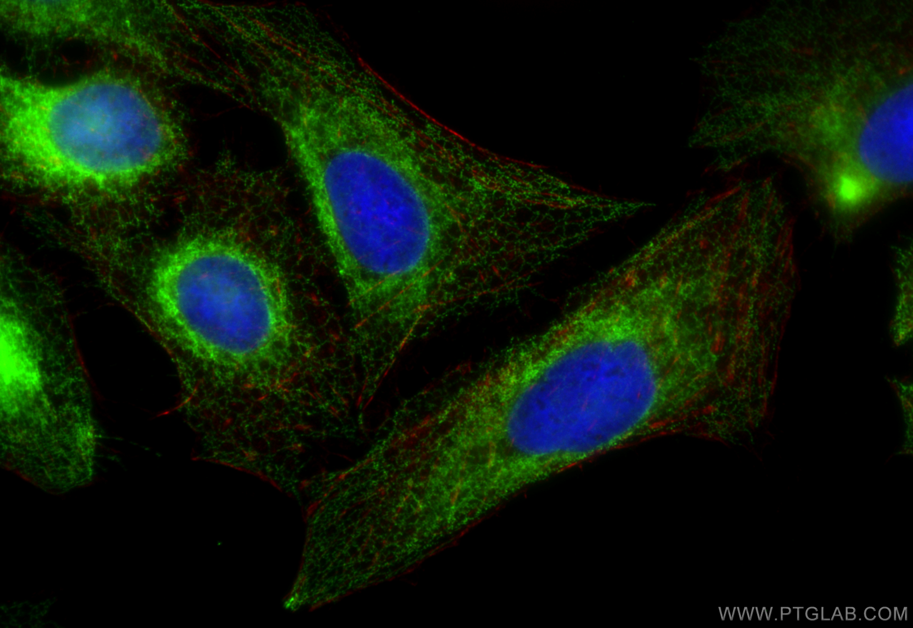 IF Staining of U2OS using 10314-1-AP