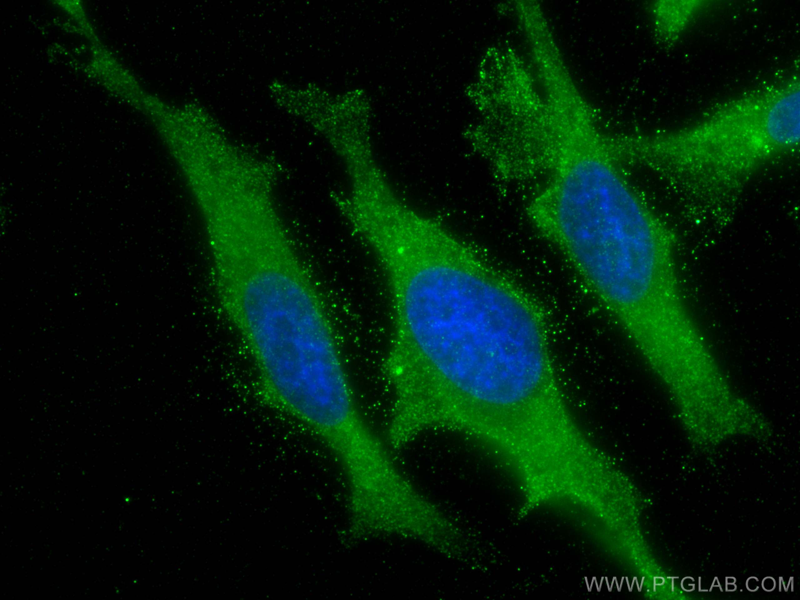 IF Staining of HeLa using 60063-1-Ig (same clone as 60063-1-PBS)