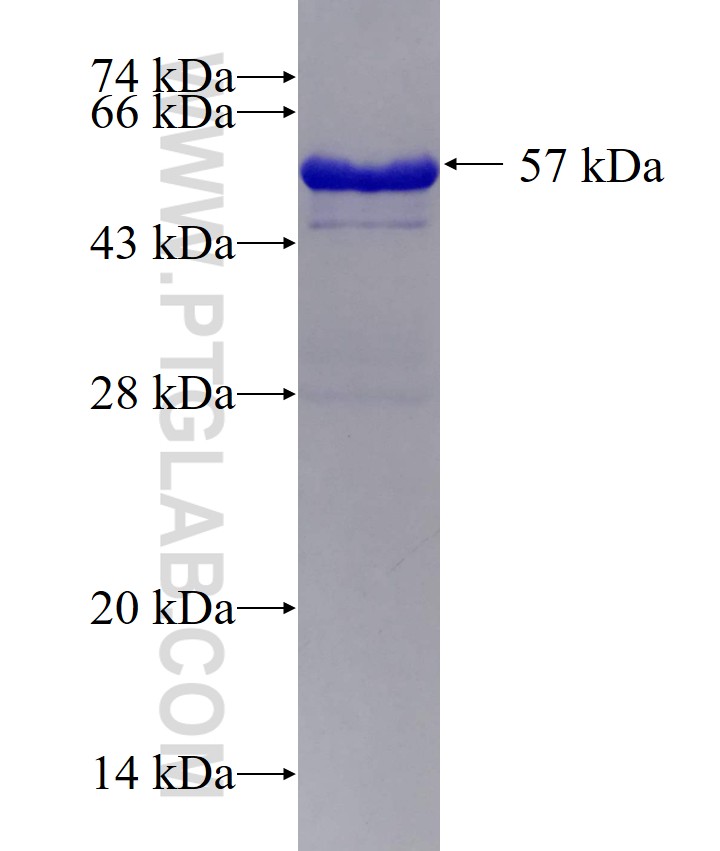 STC2 fusion protein Ag0359 SDS-PAGE