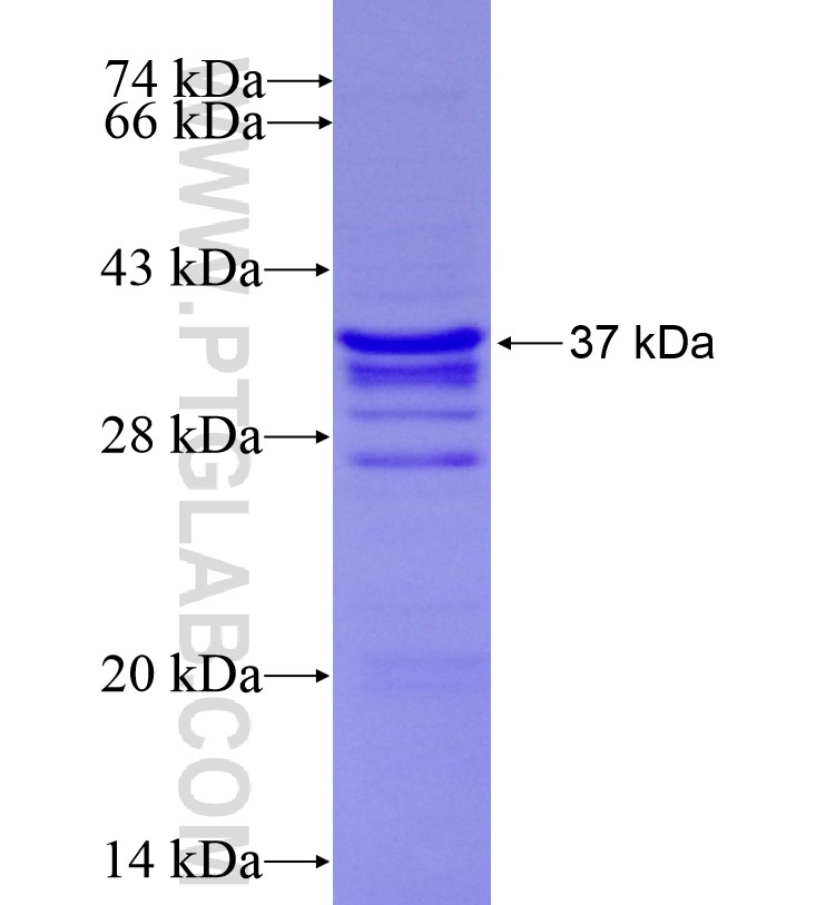 STC2 fusion protein Ag16694 SDS-PAGE STC2 fusion protein Ag16694 SDS-PAGE