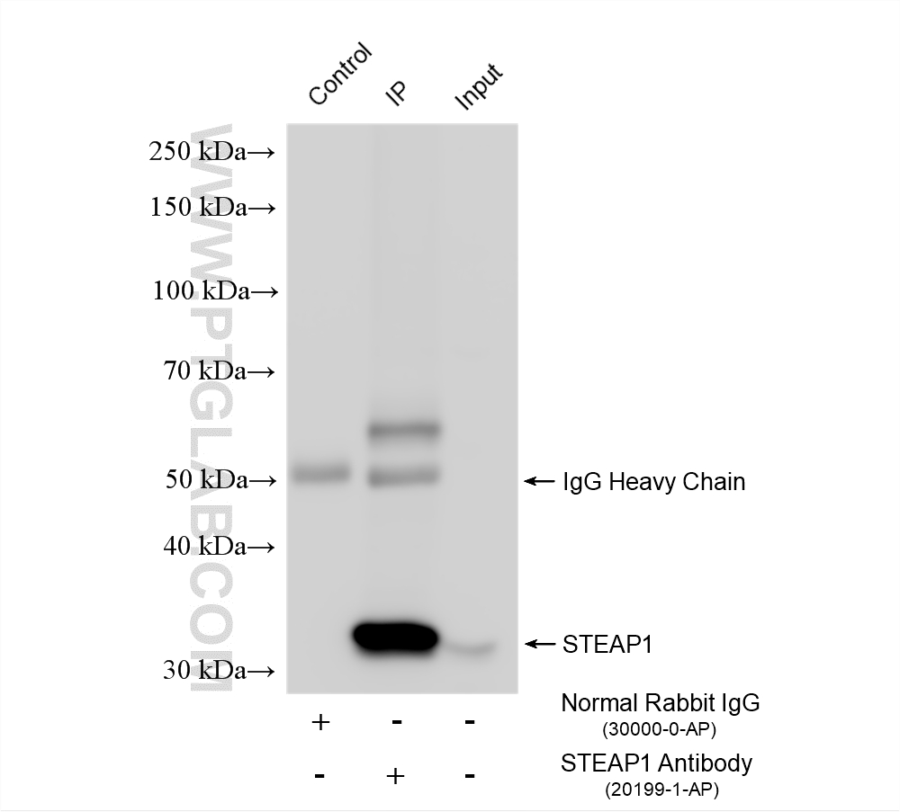 IP result of anti-STEAP1 (IP:20199-1-AP, 4ug; Detection:20199-1-AP 1:800) with LNCaP cells lysate 880 ug. IP experiment of LNCaP using 20199-1-AP