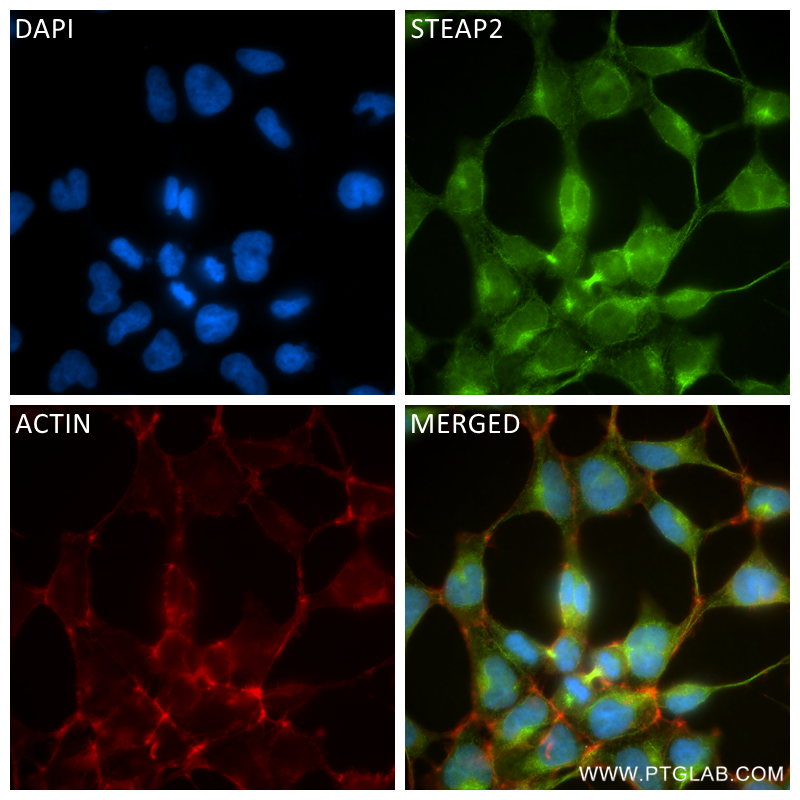 IF Staining of HEK-293 using 83611-3-RR (same clone as 83611-3-PBS)