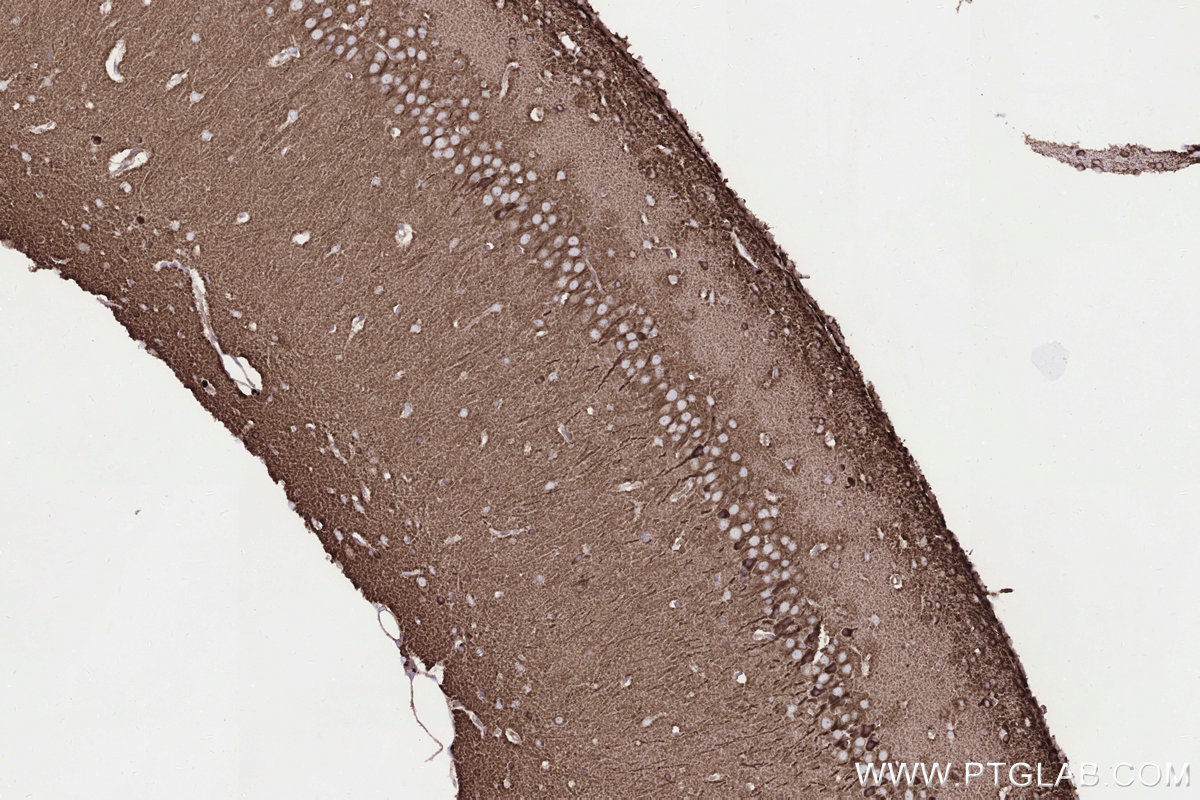 IHC staining of rat brain using 83611-3-RR IHC staining of rat brain using 83611-3-RR