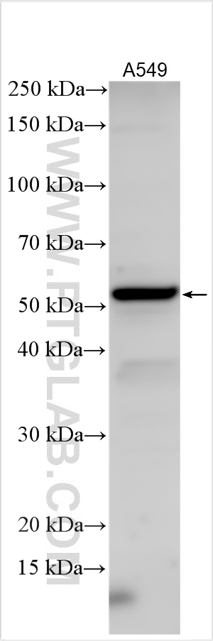WB analysis using 11944-1-AP