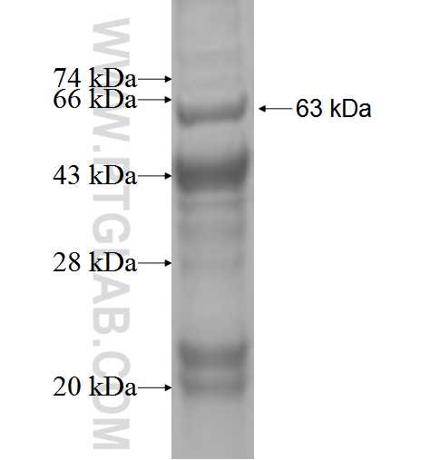 STEAP4 fusion protein Ag2545 SDS-PAGE