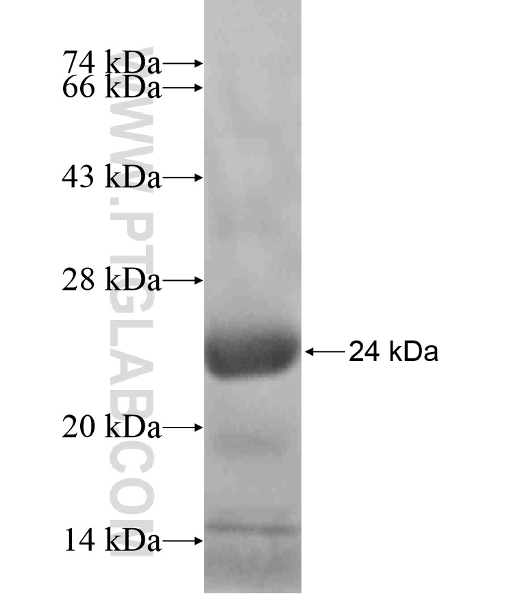 STELLAR fusion protein Ag18473 SDS-PAGE STELLAR fusion protein Ag18473 SDS-PAGE