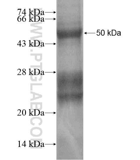 STELLAR fusion protein Ag18853 SDS-PAGE STELLAR fusion protein Ag18853 SDS-PAGE