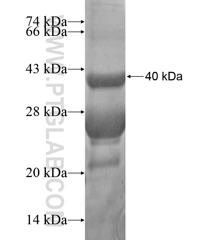 STH fusion protein Ag17541 SDS-PAGE STH fusion protein Ag17541 SDS-PAGE