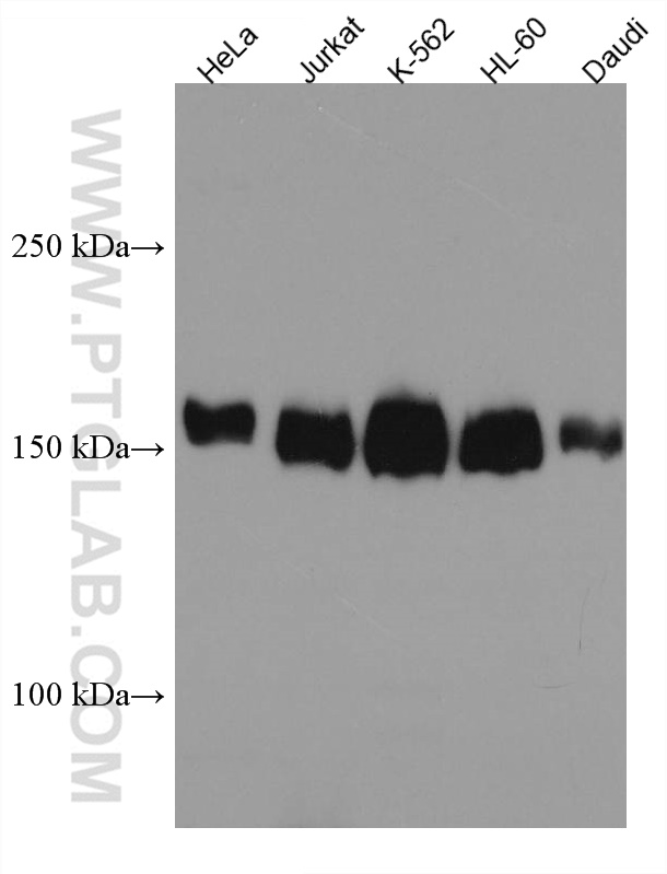 WB analysis using 66876-1-Ig