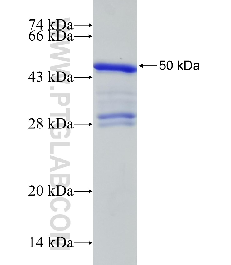 STIL fusion protein Ag32611 SDS-PAGE