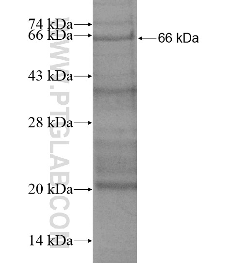STIL fusion protein Ag19501 SDS-PAGE STIL fusion protein Ag19501 SDS-PAGE