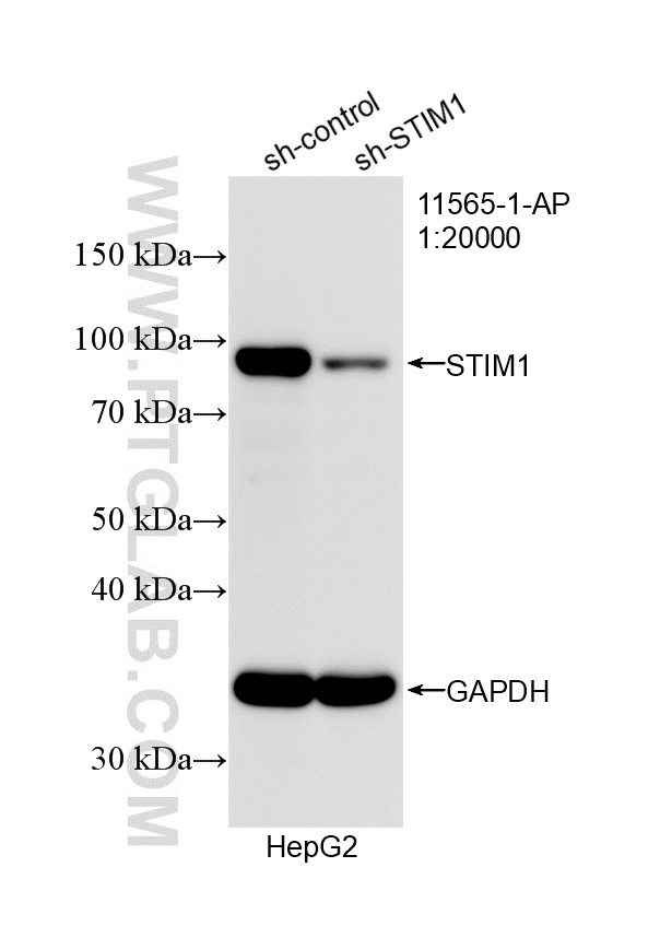 WB analysis of HepG2 using 11565-1-AP WB analysis of HepG2 using 11565-1-AP