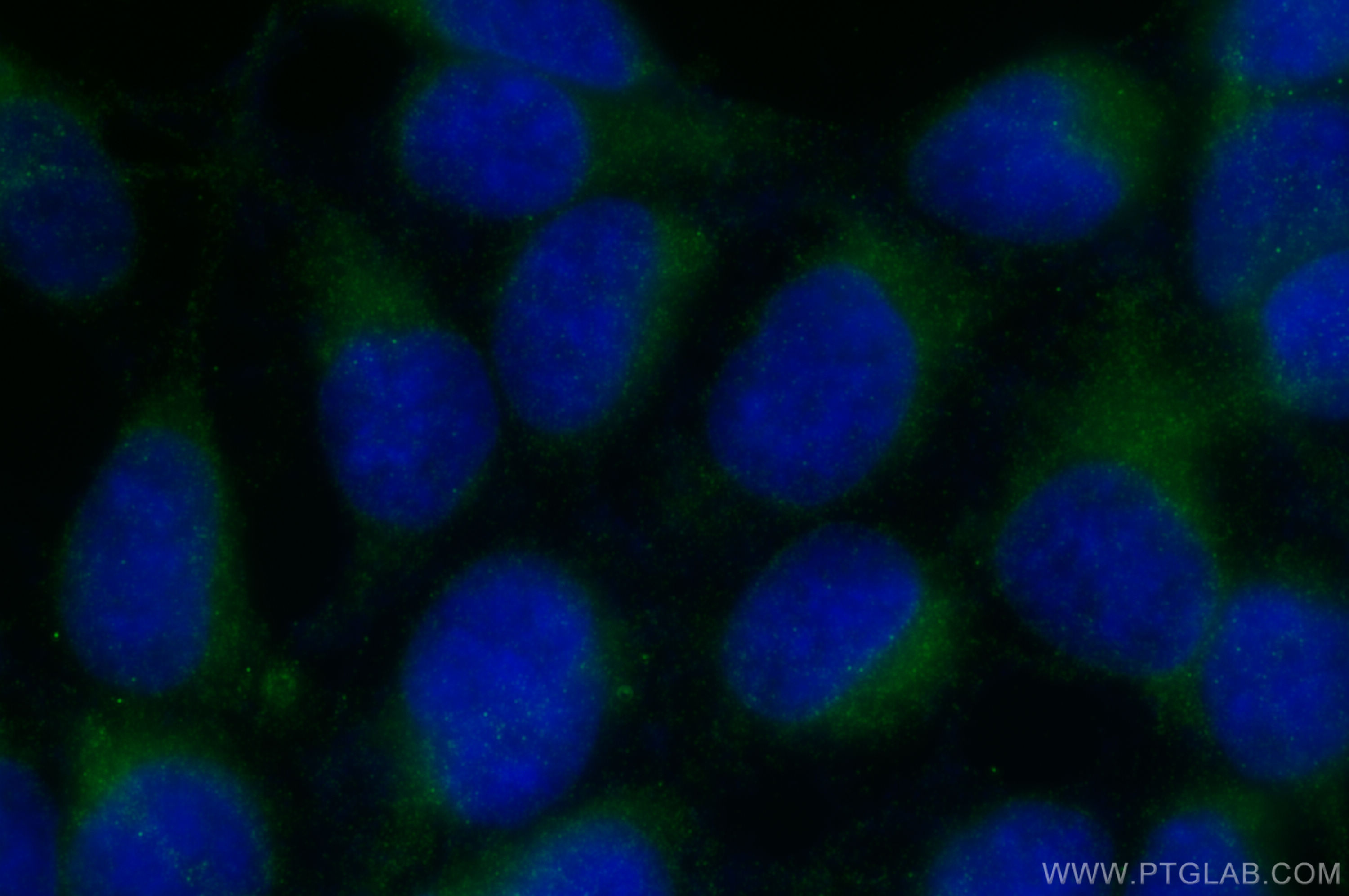 IF Staining of HEK-293 using 81156-1-RR (same clone as 81156-1-PBS)