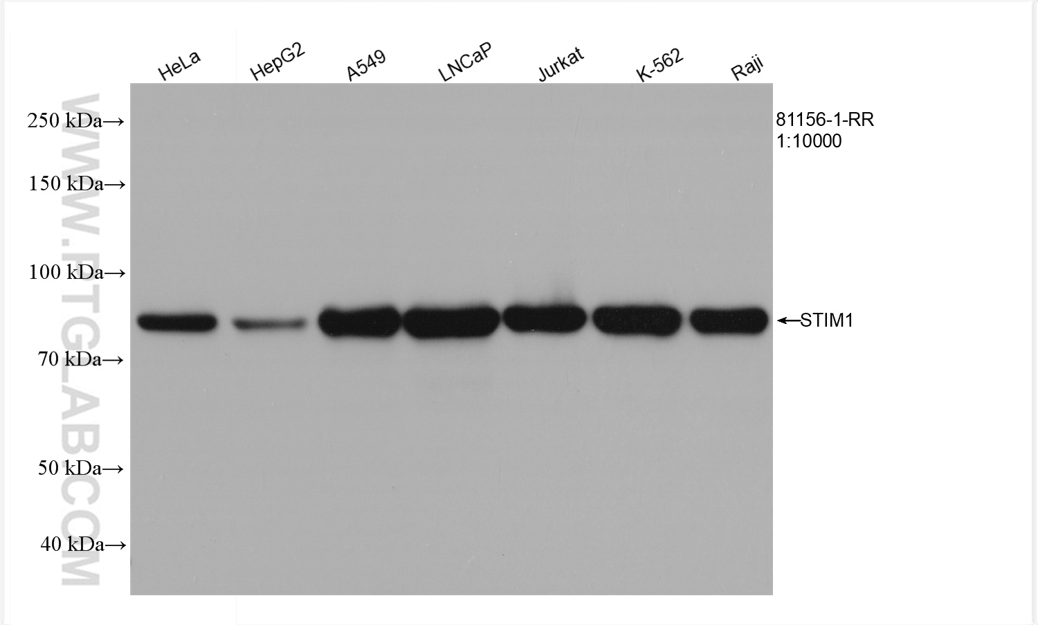 WB analysis using 81156-1-RR (same clone as 81156-1-PBS)