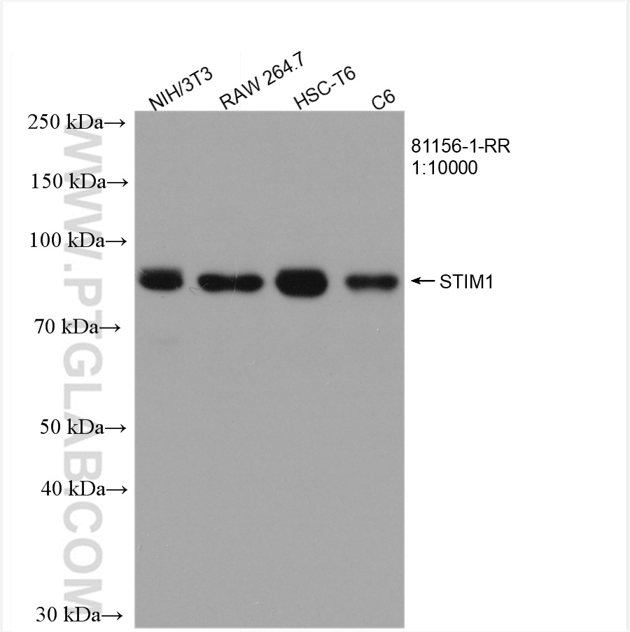 STIM1