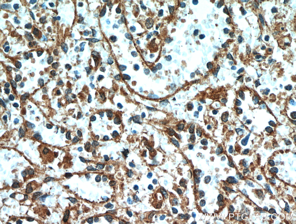 STIM2 Polyclonal antibody