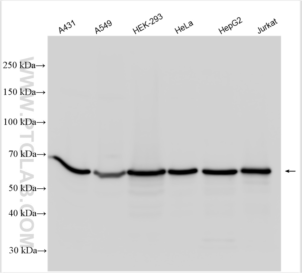 WB analysis using 15218-1-AP