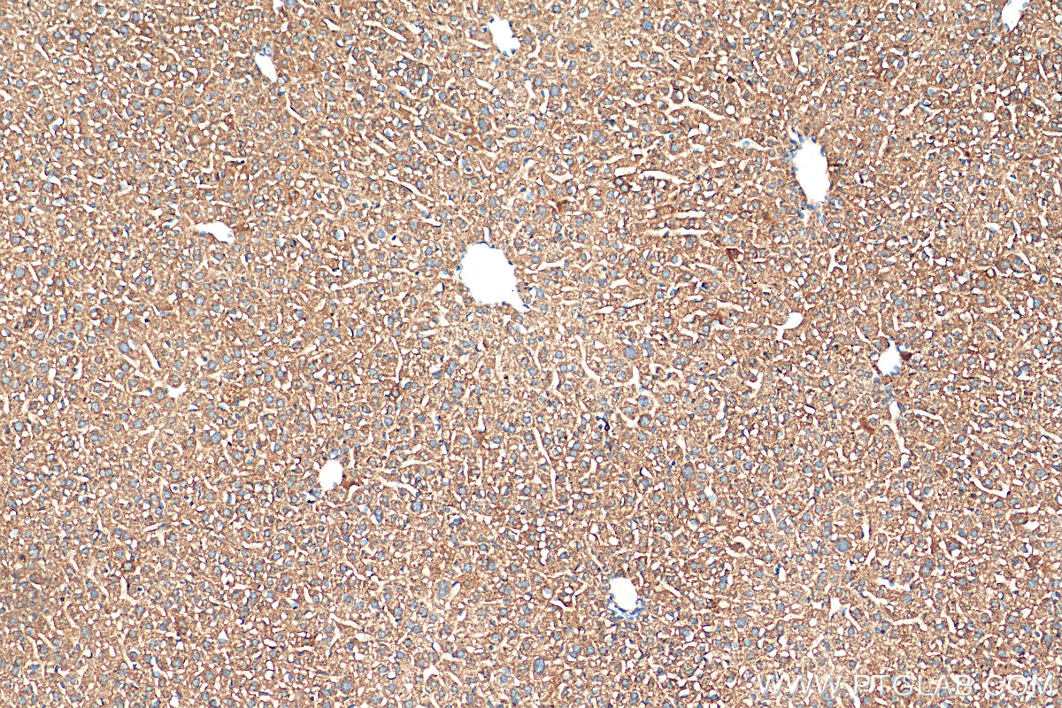 IHC staining of mouse liver using 68155-1-Ig