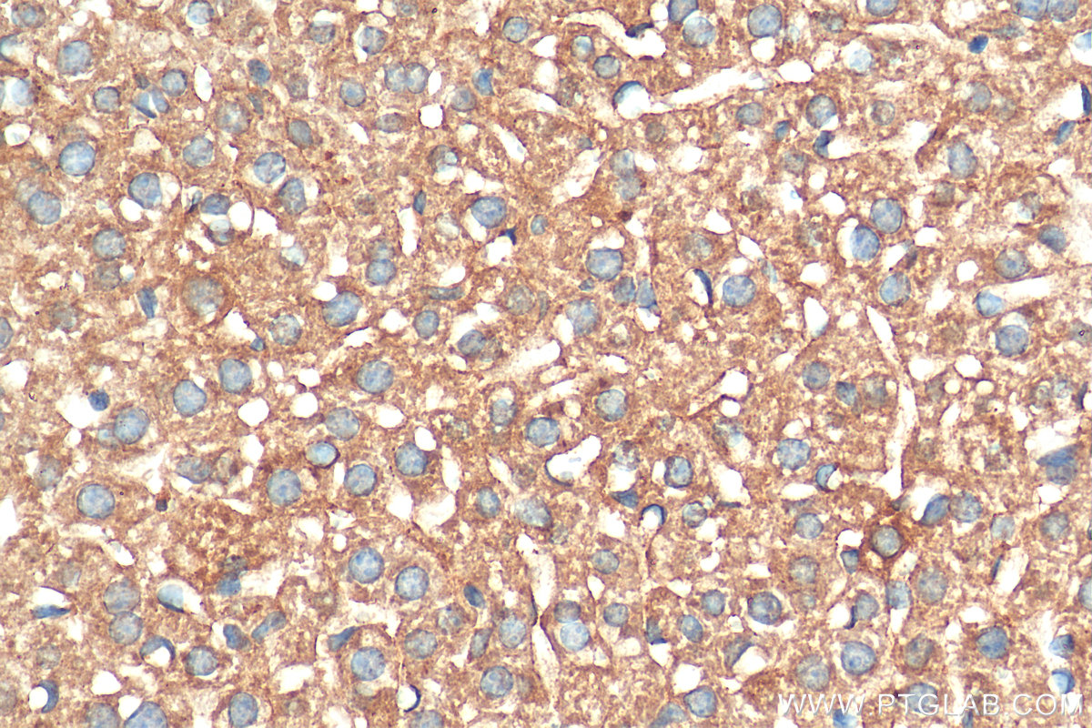 IHC staining of mouse liver using 68155-1-Ig