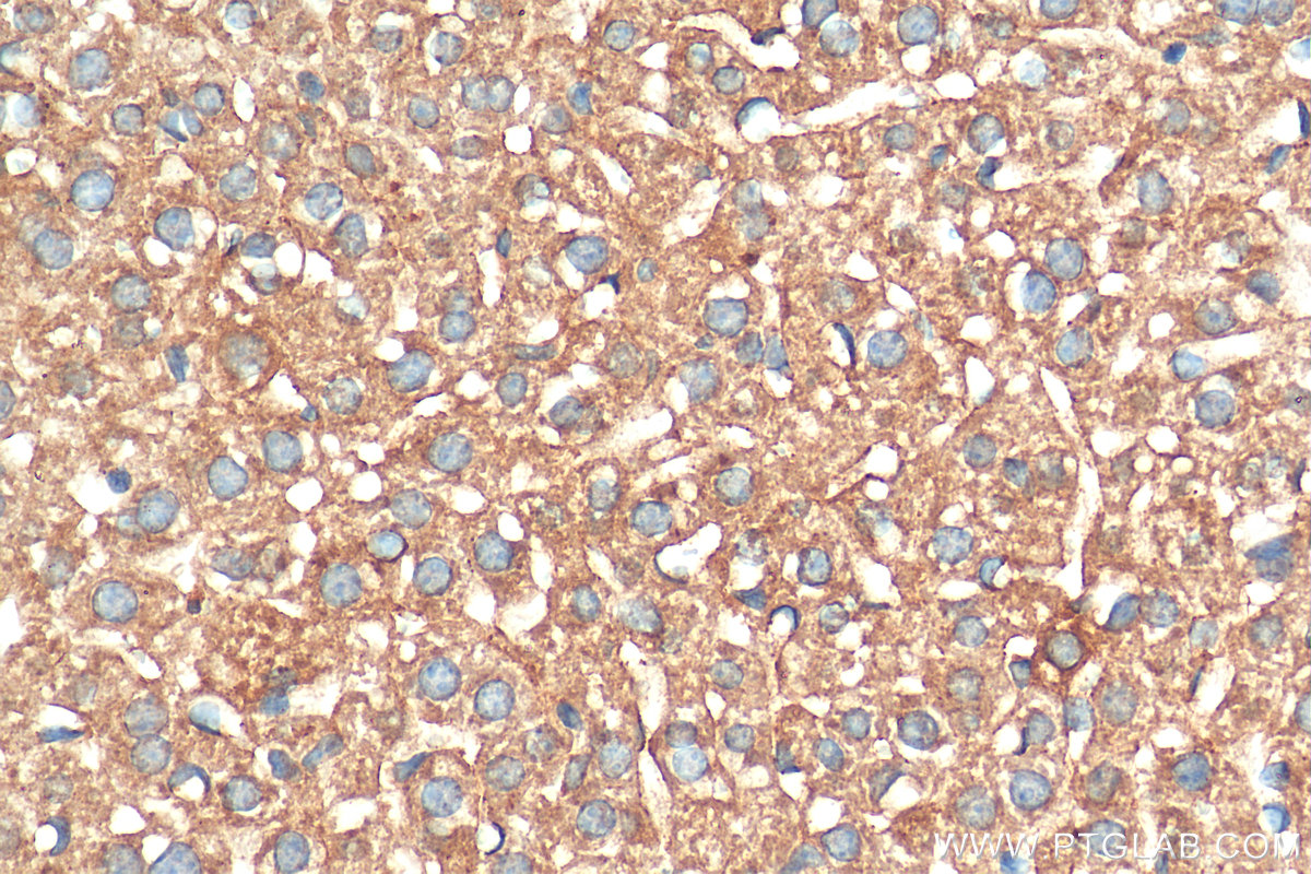 IHC staining of mouse liver using 68155-1-Ig