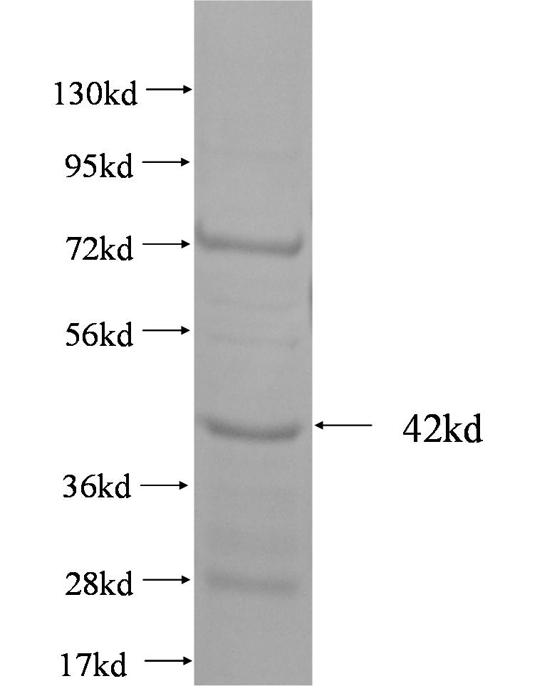 STK10 fusion protein Ag1607 SDS-PAGE