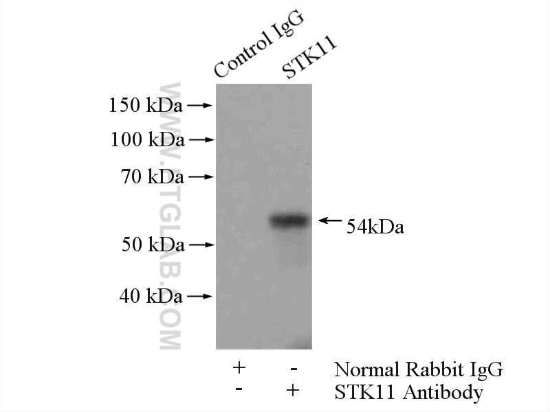 IP experiment of HEK-293 using 10746-1-AP