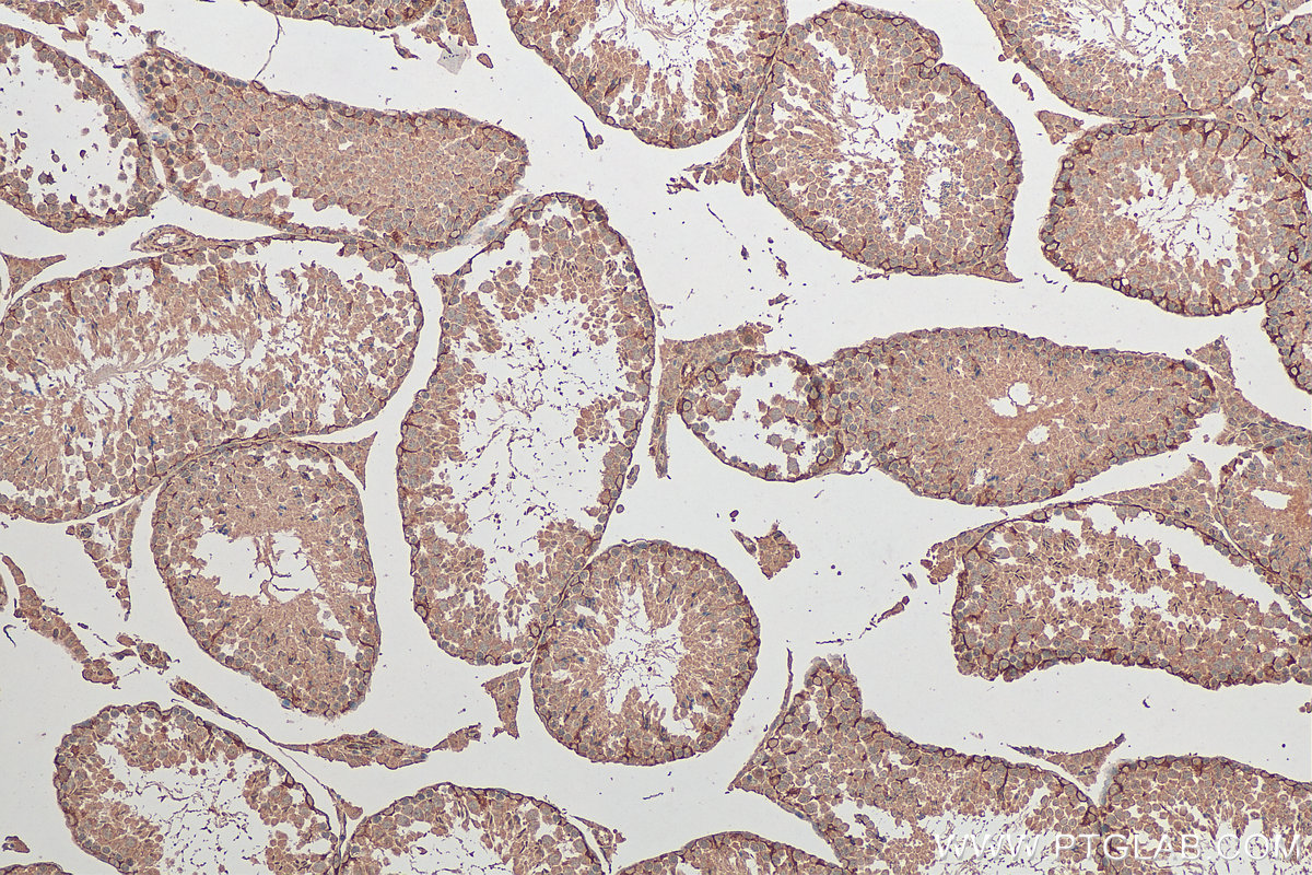 IHC staining of mouse testis using 68016-1-Ig (same clone as 68016-1-PBS)