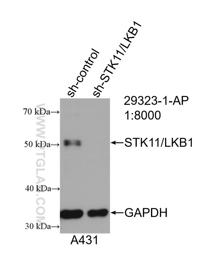 WB analysis of A431 using 29323-1-AP