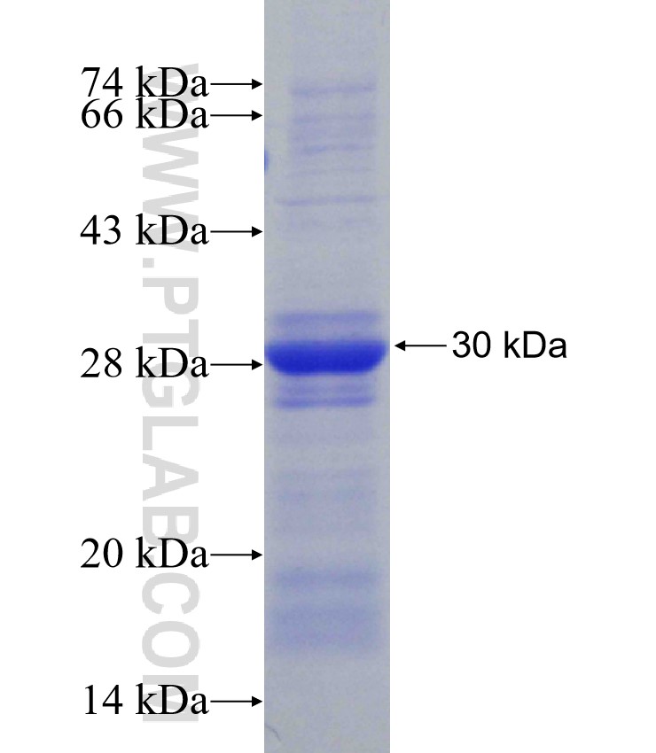 STK16 fusion protein Ag30523 SDS-PAGE