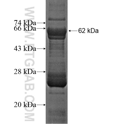 STK19 fusion protein Ag12128 SDS-PAGE STK19 fusion protein Ag12128 SDS-PAGE