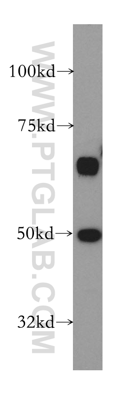 WB analysis of HeLa using 13579-1-AP