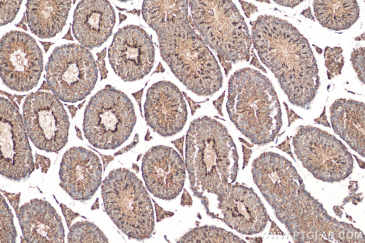 IHC staining of mouse testis using 29846-1-AP